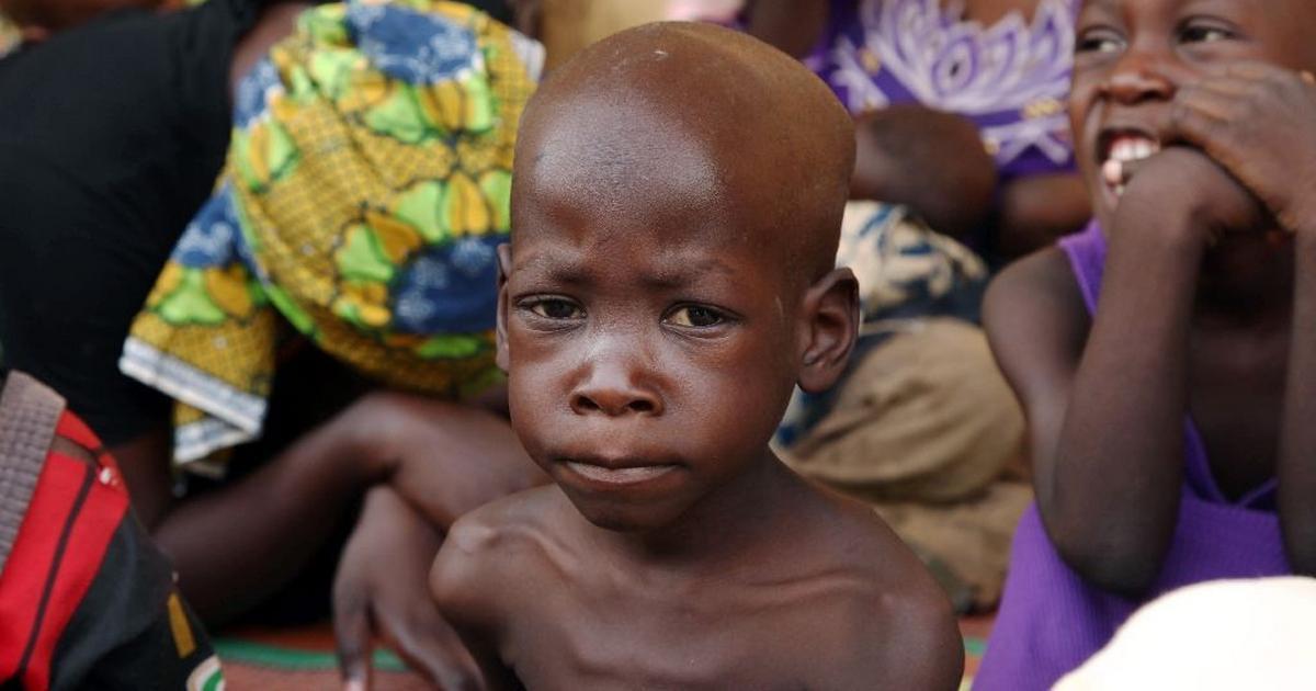 Kano accounts for highest number of malnourished children – UNICEF