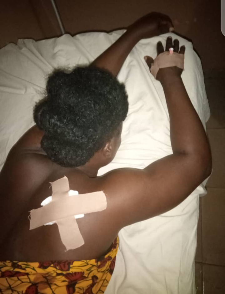 BREAKING: Unknown gunman shoots former Otukpo LGA chairman’s sister, Achawa Udeh (Photos)