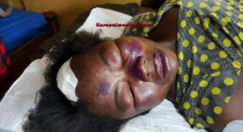 Man beats wife to coma for sleeping with another man on their matrimonial bed