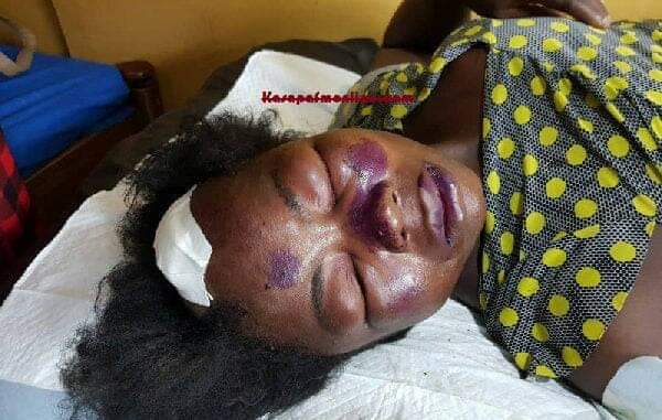 Man beats wife to coma for sleeping with another man on their matrimonial bed