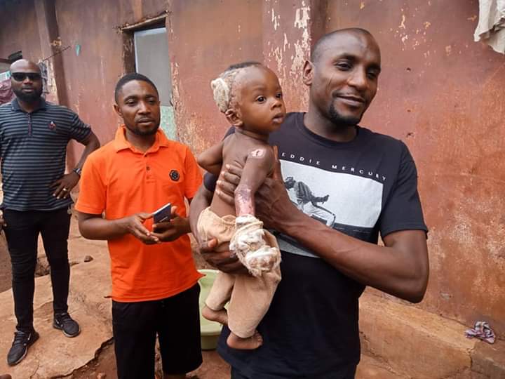 Oche G12 gives financial support to 6-month-old fire victim