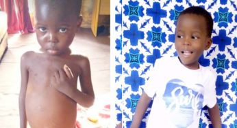 Sick boy abandoned by father transformed by Good Samaritans in Lafia (Photos/Video)