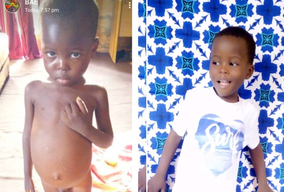 Sick boy abandoned by father transformed by Good Samaritans in Lafia (Photos/Video)