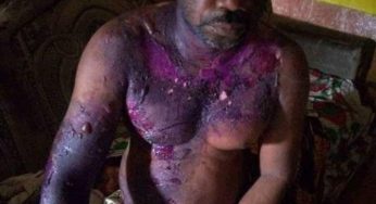 Angry wife pours hot water on husband for slapping her