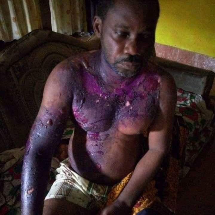 Angry wife pours hot water on husband for slapping her