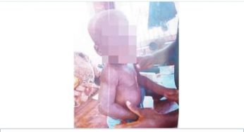 Osun driver burns 18-month-old son with cigarette