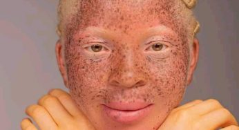 Queen Shimbe: Benue’s most celebrated albino model dazzles in new pictures