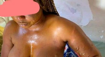 Jealous woman baths husband’s mistress with hot water in Benue 