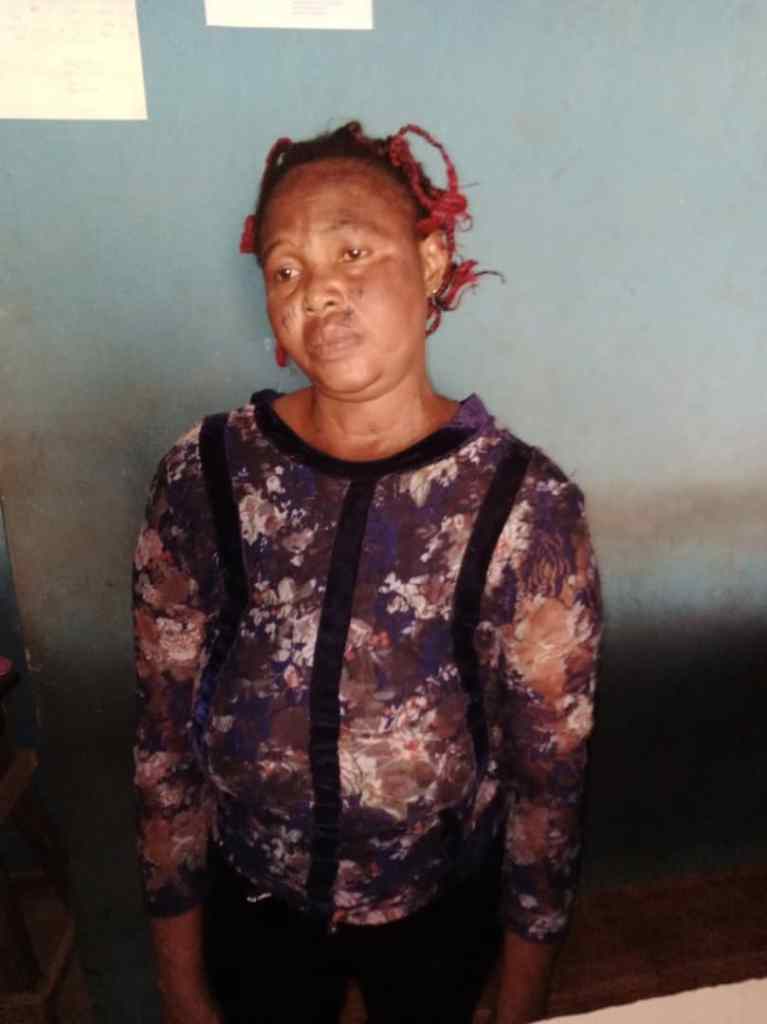 Woman burns teenage relative with hot knife over missing N5,000