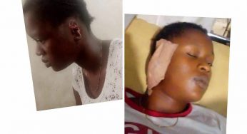 Retired police officer bites off 18-yr-old girl’s ear during quarrel in Edo