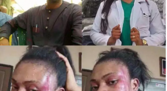 Ifeyinwa Angbo: Wife of Channels TV correspondent, Pius Angbo cries out after husband allegedly battered her