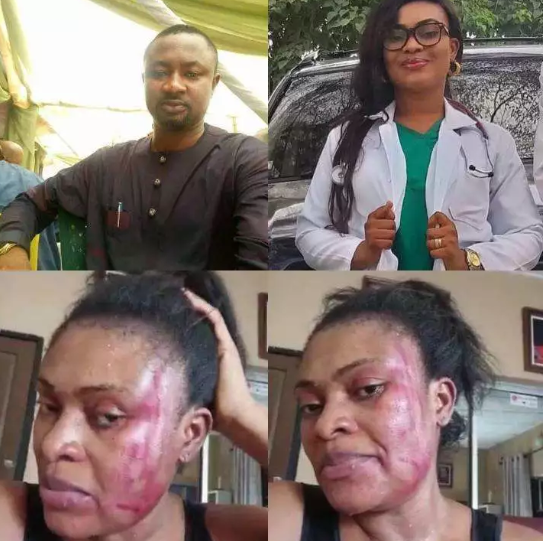 Ifeyinwa Angbo: Wife of Channels TV correspondent, Pius Angbo cries out after husband allegedly battered her