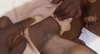 Residents lament as stray bullet hits 4-year-old boy in Otukpo