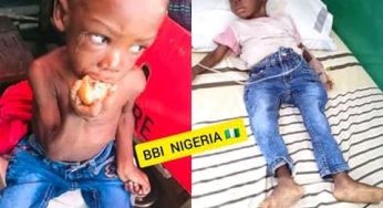 2-year-old boy rescued after being starved by his father, stepmother in Warri (Photos)