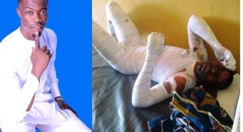 Chidinma Onah vs Esther: 18-year-old boy set on fire by his jealous girlfriend in Benue is dead