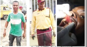 How thugs assisted LASTMA, police officers to remove driver’s teeth in Lagos