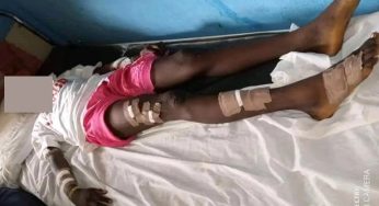 How angry mother cuts own daughter with blade, rubs pepper into wounds over missing N1500