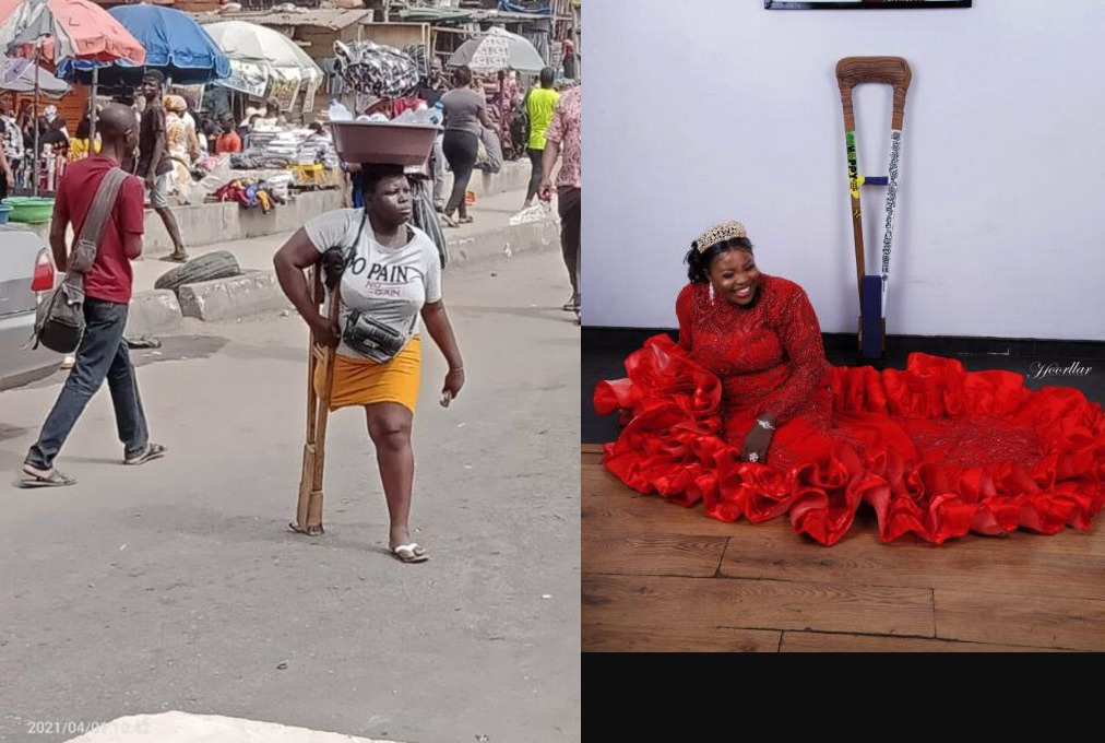 Mary Daniel: Amputee lady who hawks for survival look stunning in new photos
