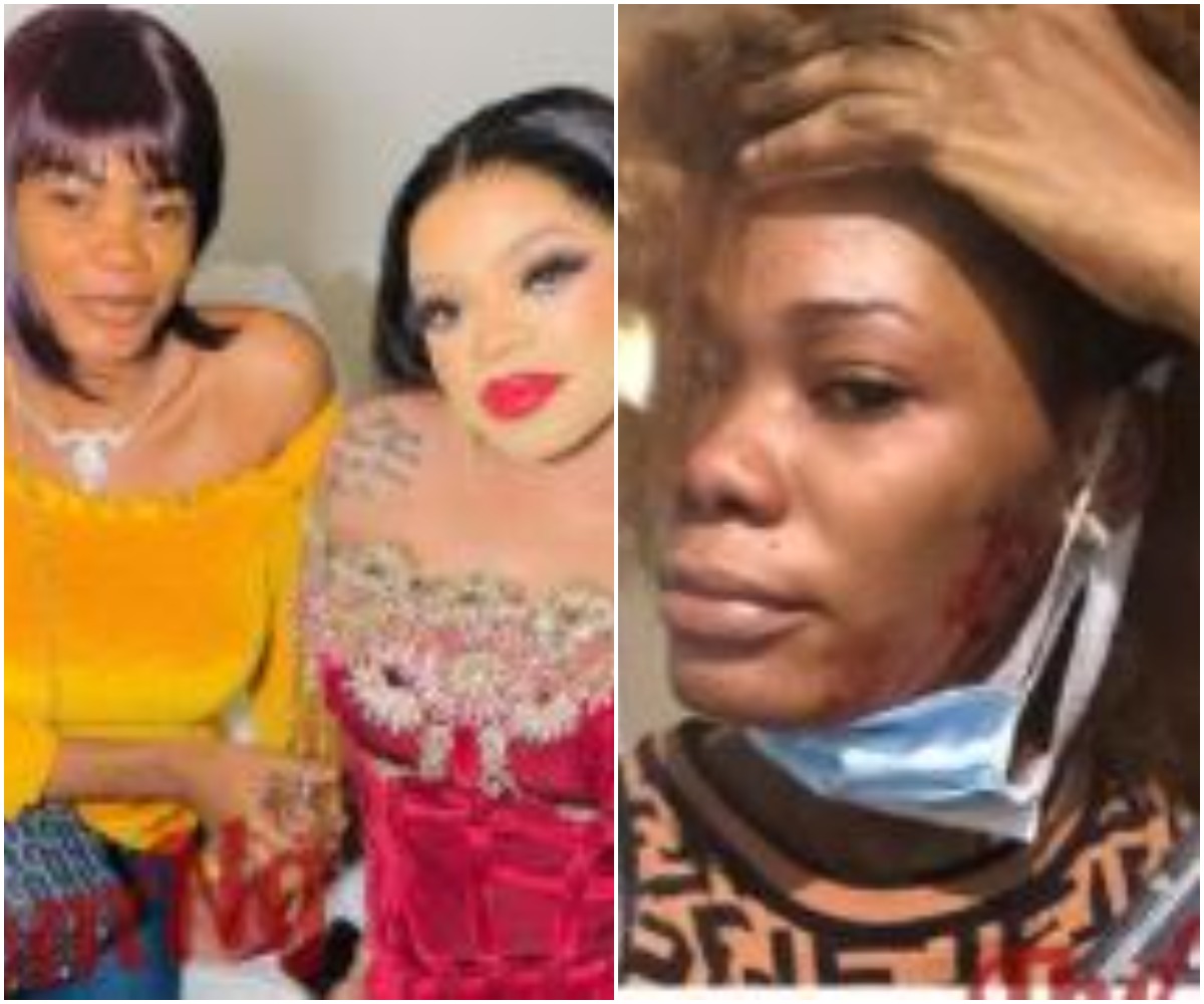 Lady Who Tattooed Bobrisky On Her Lap Cries Out After He Mercilessly Beat  Her Up |Photos | Naija News