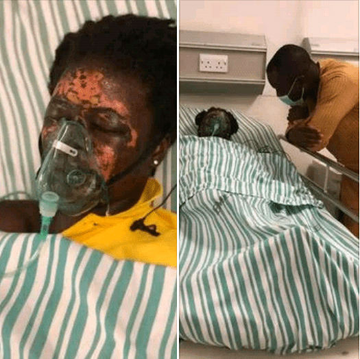 Man allegedly bathes wife with acid in Ghana (photos)