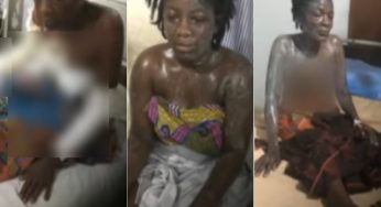 Sugar daddy pours acid on 18-year-old girlfriend, mother