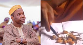 Chiwetalu Agu: Cowries, bullets removed from actor’s body after spiritual attack