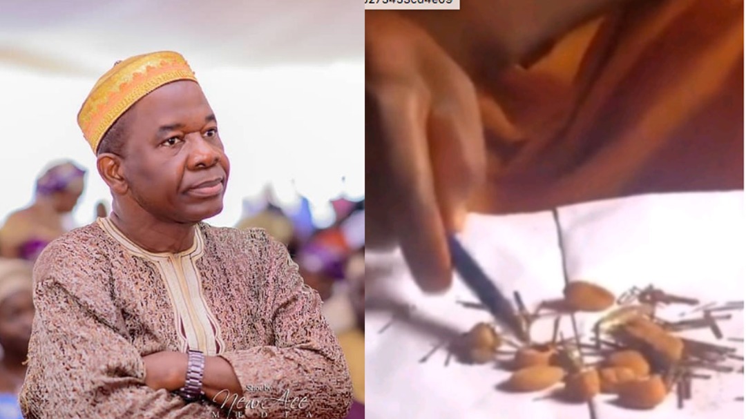 Chiwetalu Agu: Cowries, bullets removed from actor’s body after spiritual attack