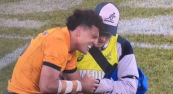 Australia vs England: Tom Banks suffers gruesome arm break