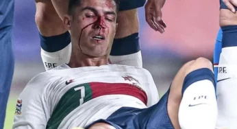 Ronaldo suffers horror injury in Portugal’s thrashing of Czech Republic