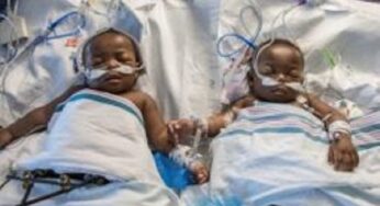 Conjoined twins born at Lagos State University die few days after delivery