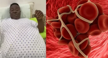 Mr Ibu: What to know about Blood Clot, cause of Ibu’s death